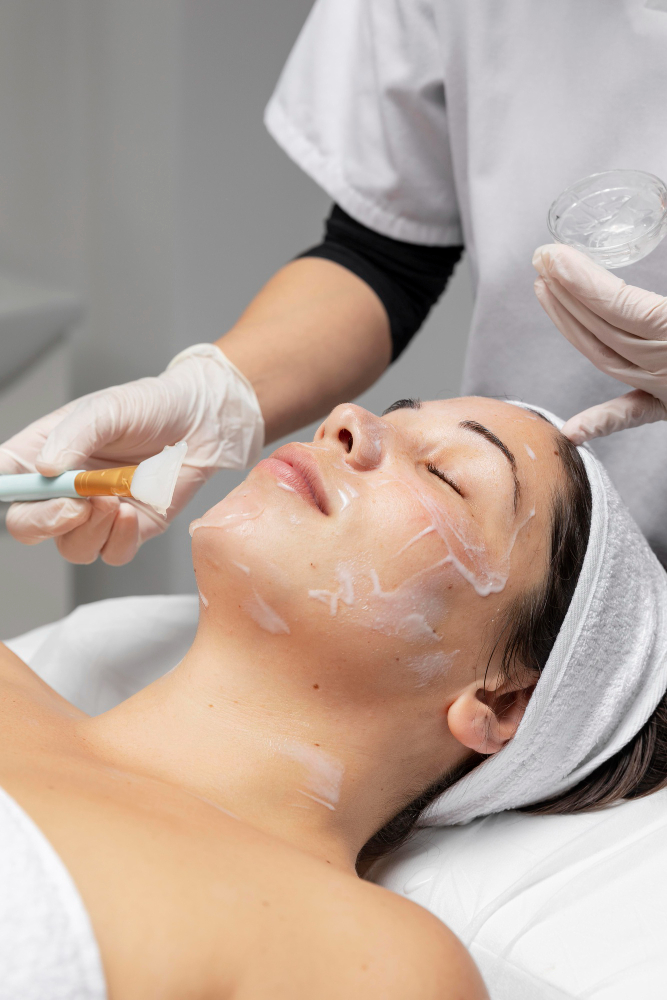 Chemical Peels for Pigmentation