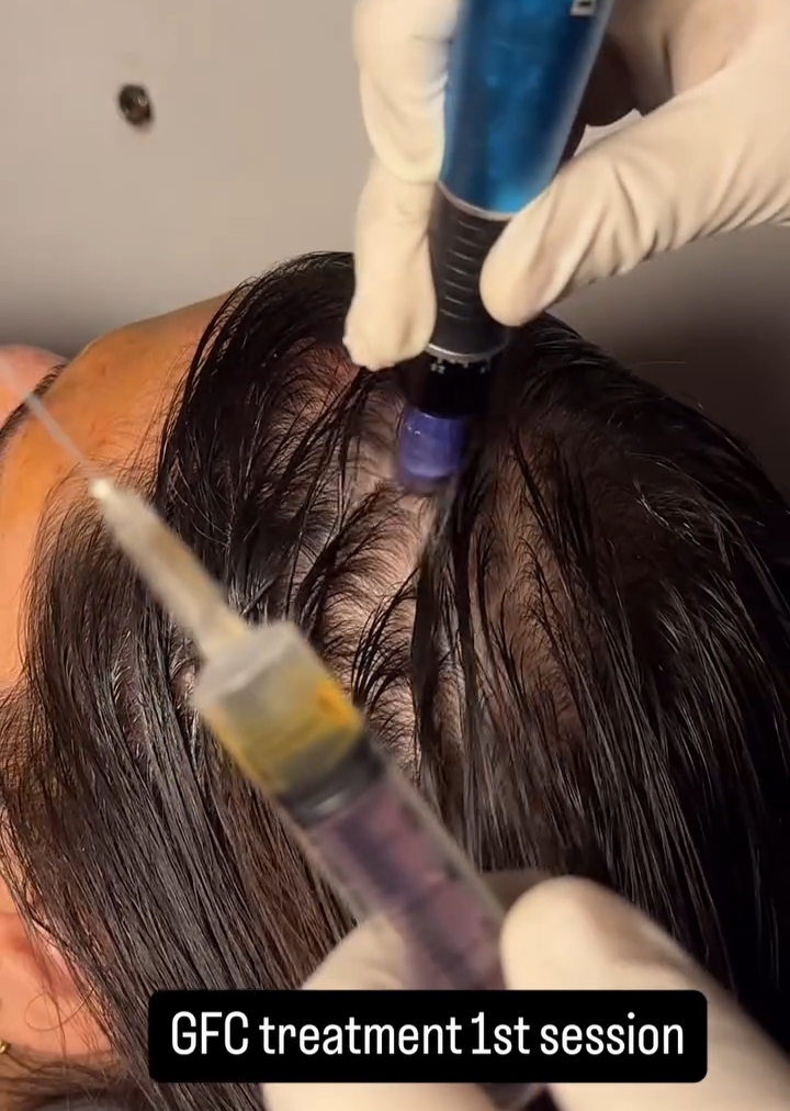 GFC Hair Therapy